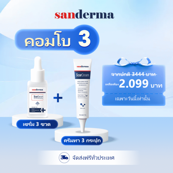 คู่หูรักษารอยแผลเป็น Sanderma – ทางออกครบวงจรเพื่อผิวเรียบเนียน